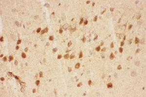 Image no. 2 for anti-Brain-Derived Neurotrophic Factor (BDNF) (AA 129-247) antibody (ABIN3043798)
