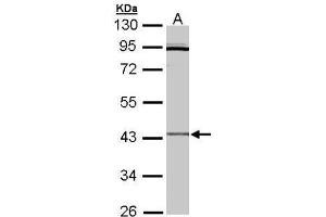 Image no. 1 for anti-Cytokine Receptor-Like Factor 1 (CRLF1) (Center) antibody (ABIN2856720)