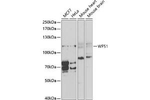 Western blot analysis of extracts of various cell lines, using WFS1 antibody (ABIN3022419, ABIN3022420, ABIN1513689, ABIN1514834 and ABIN6218806) at 1:1000 dilution.