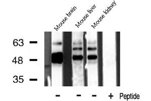 Image no. 2 for anti-Creatine Kinase, Mitochondrial 2 (Sarcomeric) (CKMT2) antibody (ABIN6257061)