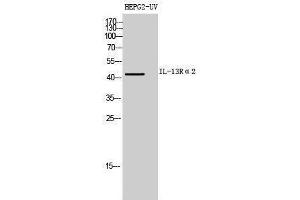 Image no. 1 for anti-Interleukin 13 Receptor, alpha 2 (IL13RA2) (Internal Region) antibody (ABIN3181455)
