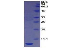 Image no. 1 for Platelet/endothelial Cell Adhesion Molecule (PECAM1) ELISA Kit (ABIN6730949)