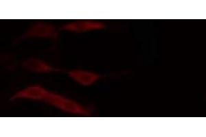 Image no. 2 for anti-Diacylglycerol Kinase, delta 130kDa (DGKD) (N-Term) antibody (ABIN6258760)