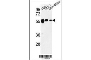 Image no. 1 for anti-Tubulin, beta 1 (TUBB1) antibody (ABIN652970)
