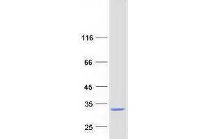 Image no. 1 for Methyltransferase Like 11A (METTL11A) protein (Myc-DYKDDDDK Tag) (ABIN2725884)