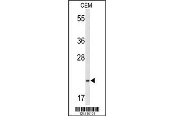 TIFA 抗体  (N-Term)