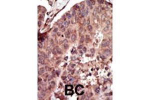 Image no. 2 for anti-Pyruvate Kinase, Liver and RBC (PKLR) (AA 521-551), (C-Term) antibody (ABIN391051)