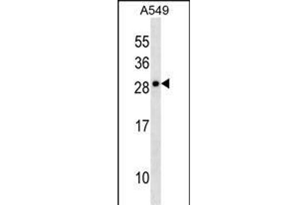 CLCF1 anticorps  (N-Term)