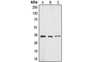 Image no. 2 for anti-ZFP36 Ring Finger Protein-Like 1 (ZFP36L1) (Center) antibody (ABIN2707267)