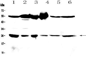 Image no. 8 for anti-Glutathione S-Transferase mu 3 (Brain) (GSTM3) (AA 93-206) antibody (ABIN5693252)