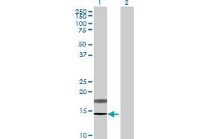 Image no. 1 for anti-Prefoldin Subunit 4 (PFDN4) (AA 1-134) antibody (ABIN518800)