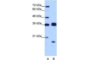 Image no. 1 for anti-Heterogeneous Nuclear Ribonucleoprotein H3 (2H9) (HNRNPH3) (N-Term) antibody (ABIN2779031)
