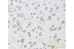 Immunohistochemistry of paraffin-embedded Mouse brain using ARL6 Polyclonal Antibody at dilution of 1:100 (40x lens).