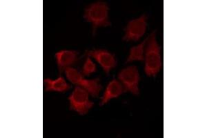 Image no. 3 for anti-BCL2-Like 1 (BCL2L1) (pSer62) antibody (ABIN6255430)