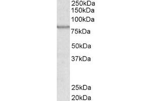 Image no. 2 for anti-ATP-Binding Cassette, Sub-Family B (MDR/TAP), Member 5 (ABCB5) (Internal Region) antibody (ABIN238622)