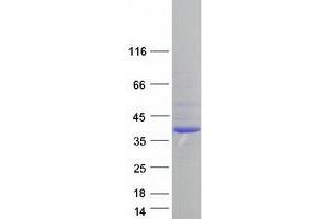 Image no. 1 for SUMO1 Activating Enzyme Subunit 1 (SAE1) (Transcript Variant 2) protein (Myc-DYKDDDDK Tag) (ABIN2731358)