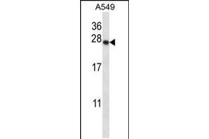 Image no. 1 for anti-Proteasome (Prosome, Macropain) 26S Subunit, Non-ATPase, 9 (PSMD9) (AA 176-205), (C-Term) antibody (ABIN5536456)