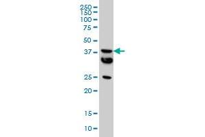 Image no. 2 for anti-Malonyl CoA:ACP Acyltransferase (Mitochondrial) (MCAT) (AA 291-390) antibody (ABIN565383)