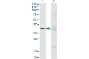 Image no. 1 for anti-Ficolin (Collagen/fibrinogen Domain Containing) 3 (Hakata Antigen) (FCN3) (AA 1-288) antibody (ABIN521997)