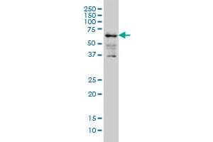 IMP-3 monoclonal antibody (M01A), clone 3B12 Western Blot analysis of IMP-3 expression in K-562 .