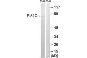 Image no. 1 for anti-Phosphatidylinositol-4-Phosphate 5-Kinase, Type I, gamma (PIP5K1C) (AA 305-354) antibody (ABIN1535167)