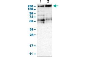 Image no. 3 for anti-Lysine (K)-Specific Demethylase 3B (KDM3B) (AA 307-448) antibody (ABIN5774356)