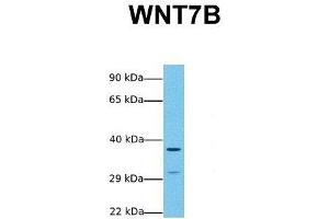 Image no. 4 for anti-Wingless-Type MMTV Integration Site Family, Member 7B (WNT7B) (Middle Region) antibody (ABIN2776732)