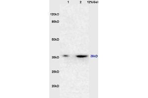Image no. 2 for anti-Tumor Necrosis Factor Receptor Superfamily, Member 10d, Decoy with Truncated Death Domain (TNFRSF10D) (AA 151-250) antibody (ABIN1713482)