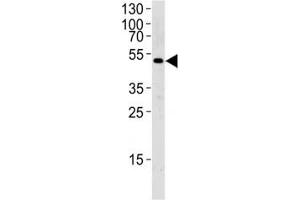 Image no. 4 for anti-Suppressor of Cytokine Signaling 4 (SOCS4) (AA 227-254) antibody (ABIN3029046)