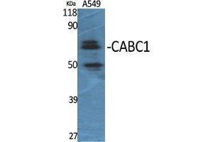 Image no. 2 for anti-Coenzyme Q8A (COQ8A) (Internal Region) antibody (ABIN3183601)