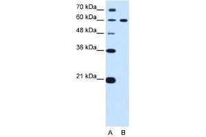 Image no. 1 for anti-Deltex Homolog 2 (DTX2) antibody (ABIN630801)