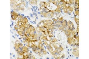 Immunohistochemistry of paraffin-embedded Human stomach using GHRL Polyclonal Antibody at dilution of 1:100 (40x lens).