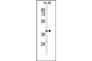 Image no. 1 for anti-Mitochondrially Encoded Cytochrome B (MT-CYB) (AA 207-237), (Middle Region) antibody (ABIN951796)