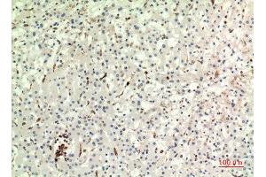 Image no. 2 for anti-HLA-DR-gamma (CD74) (Internal Region) antibody (ABIN3187958)