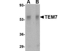 Image no. 2 for anti-Plexin Domain Containing 1 (PLXDC1) (Center) antibody (ABIN500901)