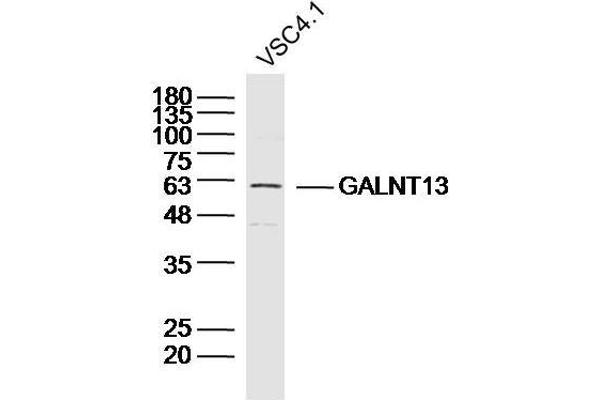 GALNT13 Antikörper  (AA 351-450)