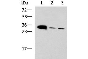 Western blot analysis of Mouse heart tissue Mouse stomach tissue and PC-3 cell lysates using PSCA Polyclonal Antibody at dilution of 1:650
