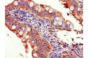 Immunohistochemistry of paraffin-embedded human small intestine tissue using ABIN7152149 at dilution of 1:100
