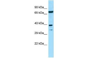 Image no. 1 for anti-Eukaryotic Translation Initiation Factor 2B, Subunit 2 Beta, 39kDa (EIF2B2) (N-Term) antibody (ABIN2790210)
