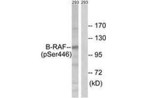 Image no. 1 for anti-Small Nuclear Ribonucleoprotein Polypeptide E (SNRPE) (AA 411-460), (pSer446) antibody (ABIN1532038)