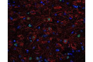 Indirect immunolabeling of PFA fixed, paraffin embedded mouse brain section with guinea pig anti-Tbr 1 (dilution 1 : 500; green) and rabbit anti-neurofilament H (cat.