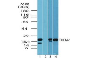 Image no. 1 for anti-Acyl-CoA Thioesterase 13 (ACOT13) (AA 25-75) antibody (ABIN960070)