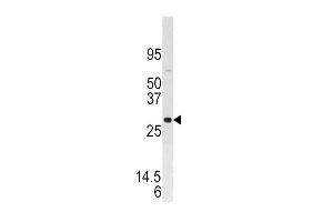 Dual Specificity Phosphatase 3 (DUSP3) (AA 1-30), (N-Term) 抗体