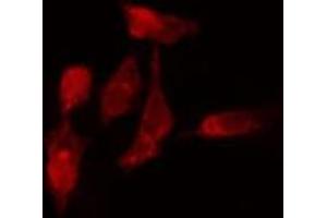 Image no. 1 for anti-Ribosomal Protein L7-Like 1 (RPL7L1) (Internal Region) antibody (ABIN6259344)