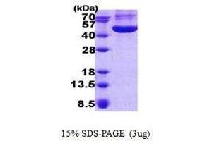 Image no. 1 for Chitinase 3-Like 1 (Cartilage Glycoprotein-39) (CHI3L1) protein (ABIN2128523)