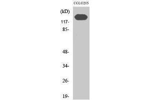 Image no. 1 for anti-Cadherin 2 (CDH2) (C-Term) antibody (ABIN3185774)