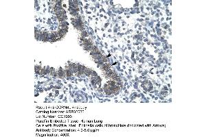 Image no. 1 for anti-CCR4 Carbon Catabolite Repression 4-Like (CCRN4L) (N-Term) antibody (ABIN2779705)