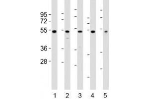 Image no. 1 for anti-Nuclear Factor of kappa Light Polypeptide Gene Enhancer in B-Cells Inhibitor, epsilon (NFKBIE) (N-Term) antibody (ABIN3028886)