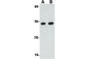Image no. 2 for anti-Polymerase (RNA) III (DNA Directed) Polypeptide F, 39 KDa (POLR3F) (N-Term) antibody (ABIN6656851)