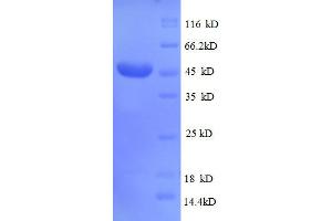 Image no. 1 for CD320 Molecule (CD320) (AA 36-231), (partial) protein (GST tag) (ABIN1046800)
